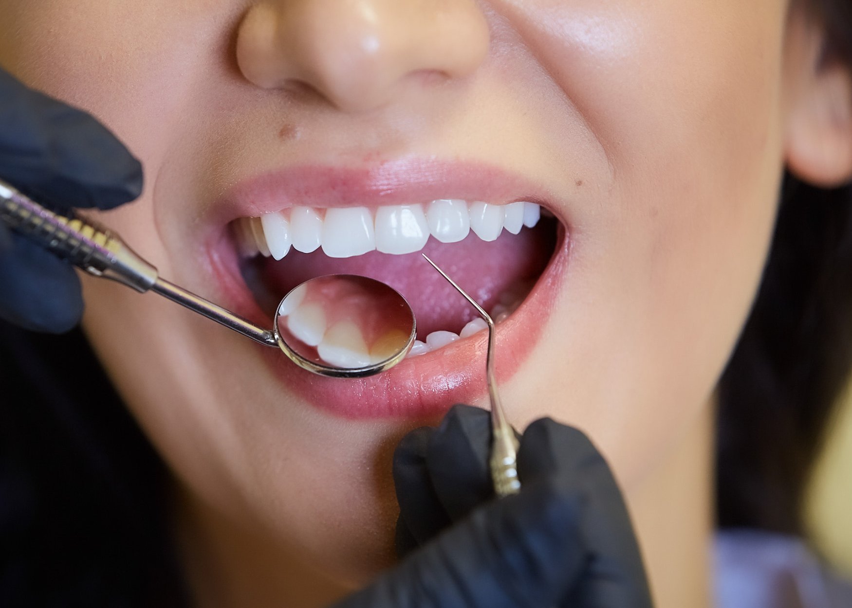 You are currently viewing How Often Should You Schedule a Dental Checkups?