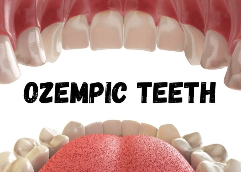Ozempic teeth -Learn the utmost importance of maintaining proper oral care