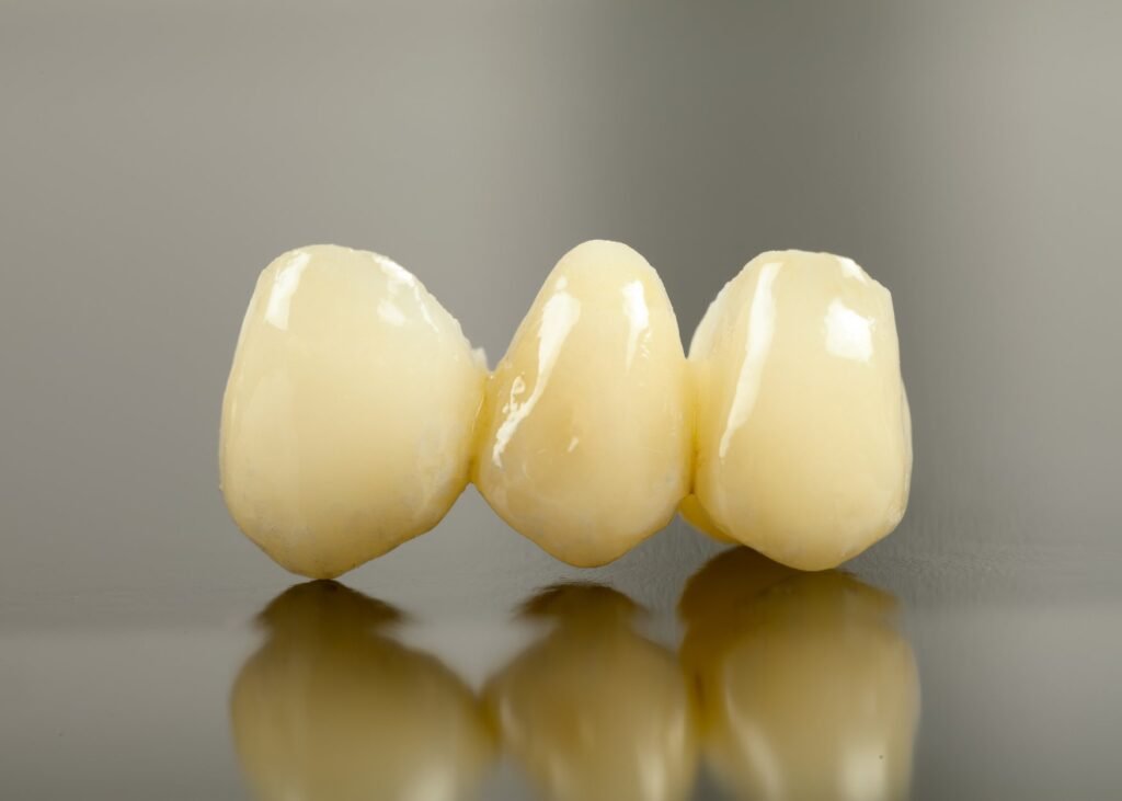 Tooth replacement options at Sparsh Dental Clinic in Bilaspur: implants, dentures, and bridges for a healthy smile.