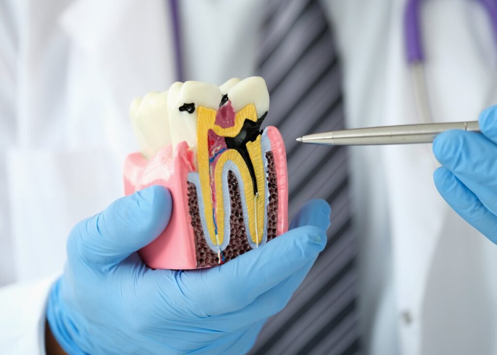 Expert root canal treatment at Sparsh Dental Clinic in Bilaspur, ensuring pain relief and restoring your dental health effectively.